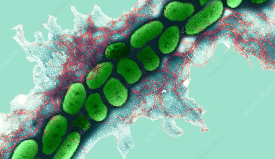 ^BErwinia bacteria.^b Coloured transmission electron micrograph (TEM) of ^IErwinia carotovora^i bacteria (subspecies ^Icarotovora^i). This gram-negative flagellated bacterium causes soft rot of plant crops such as potato, cabbage and carrot. It is found worldwide, and can survive in soil and surface water when not infecting the roots of plants. Magnification: x12,000 when printed 10cm wide.